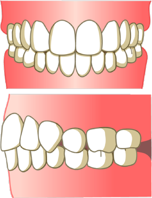 矯正歯科
